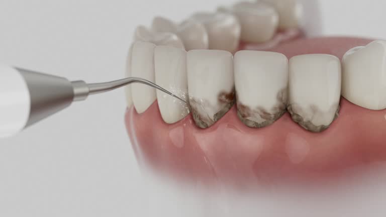 Trusted Teeth Cleaning And Checkup service in Thousand Palms, CA - Dentist Open Now
